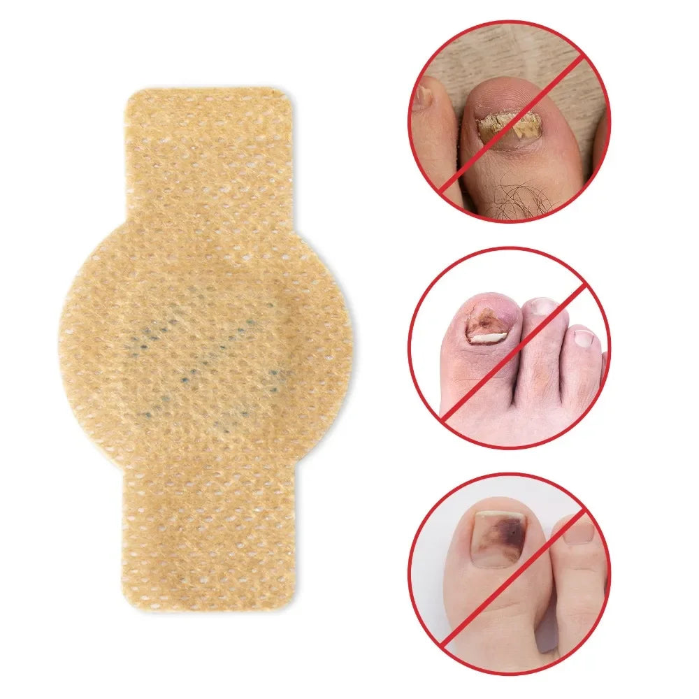 #1 Fungal Nail Patches 21 Pcs