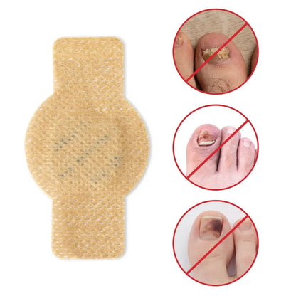 #1 Fungal Nail Patches 21 Pcs